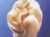 Finally, the ideal Dental Filling! - Image 2