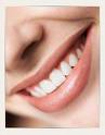 How do Veneers compare to Thineers? Which would you recommend? - Image 1