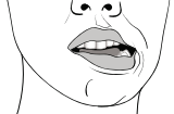 I cannot open my mouth properly after my dental injection! - Image 3