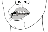 I cannot open my mouth properly after my dental injection! - Image 4