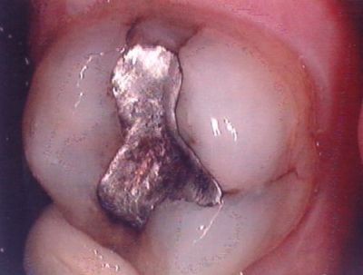 No Metal Please! - Image 1