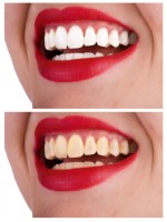 Test your Dental IQ - Image 1