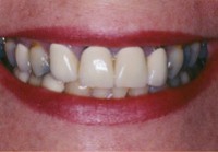 Test your Dental IQ - Image 2