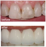 Test your Dental IQ - Image 2