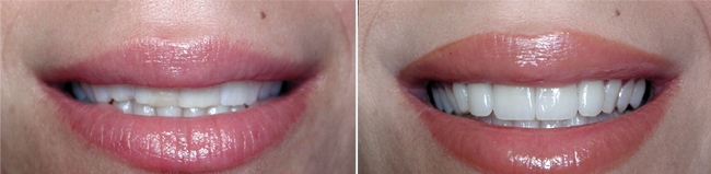 The magic of longer teeth - Image 2