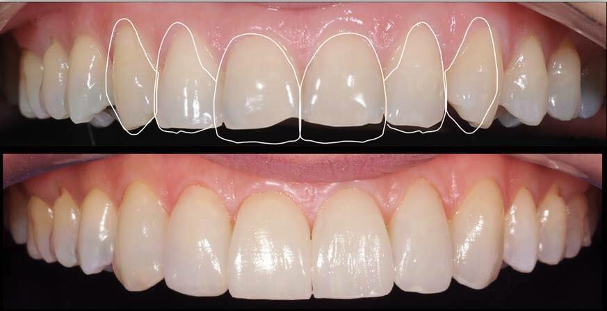 The magic of longer teeth - Image 6