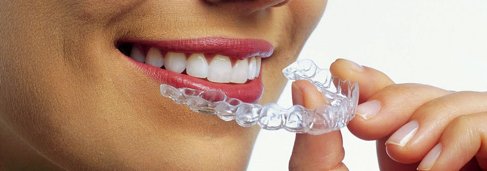 The SMILE TRIANGLE: The 5 STEP plan to your best smile - Image 14