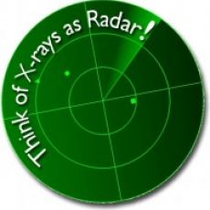 The Radar of Dentistry – Why x-rays are so important