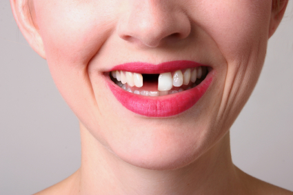 Dental Implants: The procedure (video)
