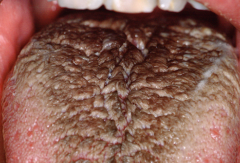 Hair on your tongue?