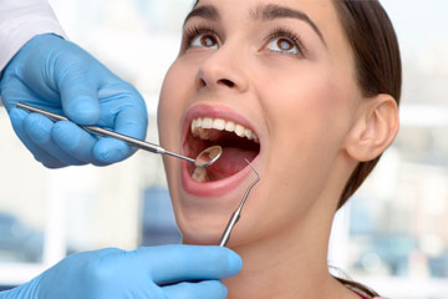 Maintenance for Resin Veneers