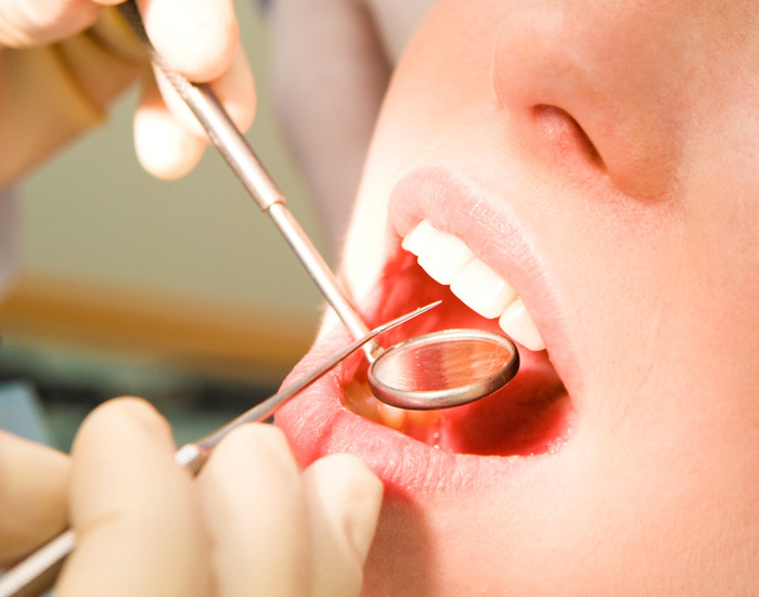 Shortage of dentists raises risk of cancer