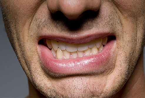 Studies find Botox can reduce nighttime bruxism