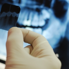 Are We Getting Too Much Radiation From Dental X-Rays?