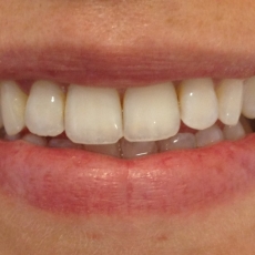 Smile Project: 1