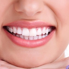 Our 4-in-1 Super Spring teeth whitening special!