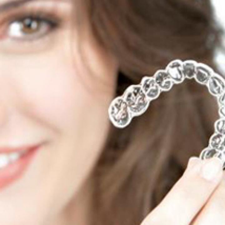 Clear Aligners - No Wires!