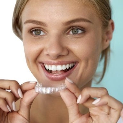 Clear Aligners Consultation