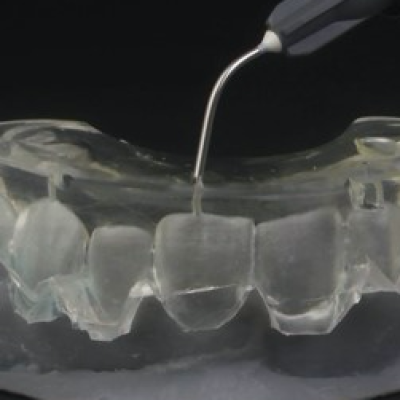 Resin Injection Moulding