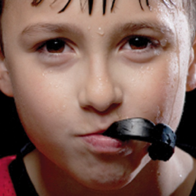 Custom Mouth / Sports Guards