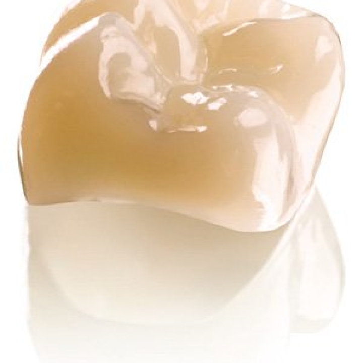 Cerec Crowns