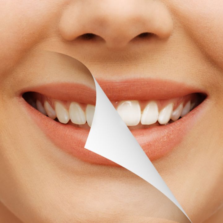 Cosmetic Dentistry Cape Town