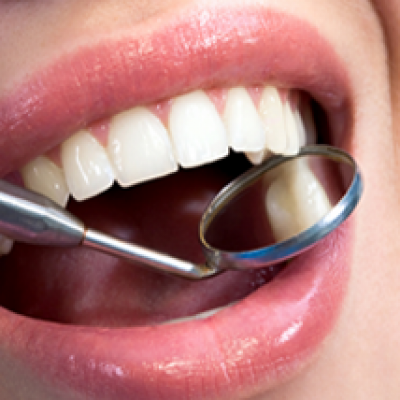 Dental Exam & Cavity Check